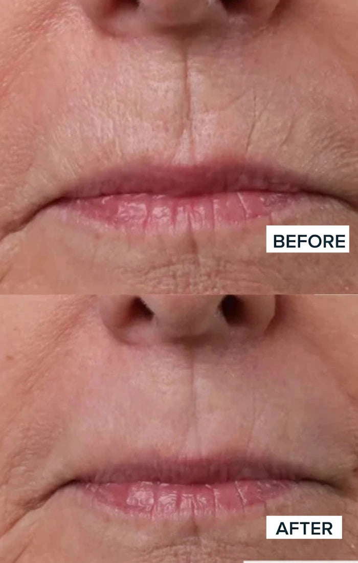 Before and after result