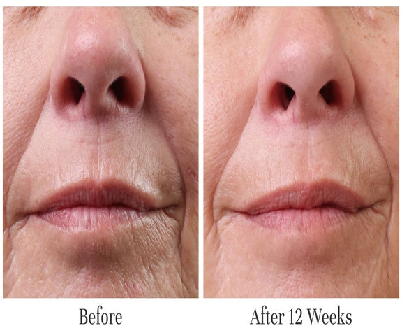 Visibly Smooths Vertical Wrinkles