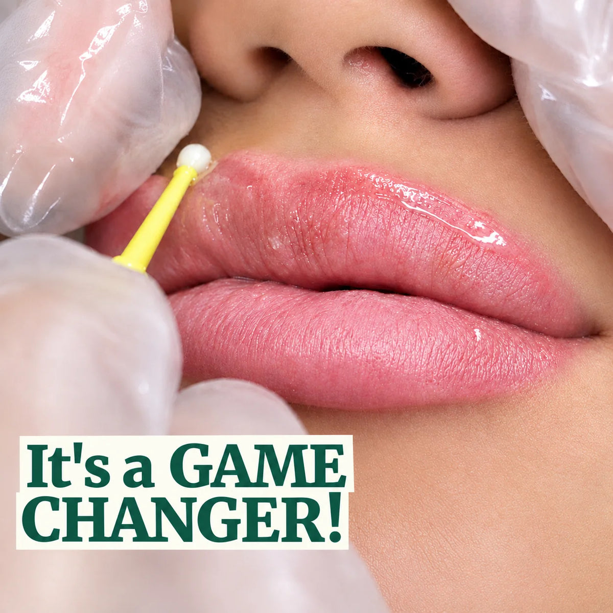 Stubborn Fine Lines And Thin Lips? Here's Why 50,000+ Women Canceled Their Filler Appointments