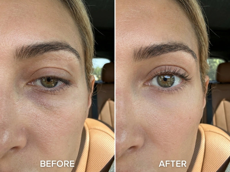 Before and after result