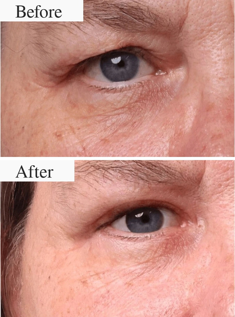Before and after result