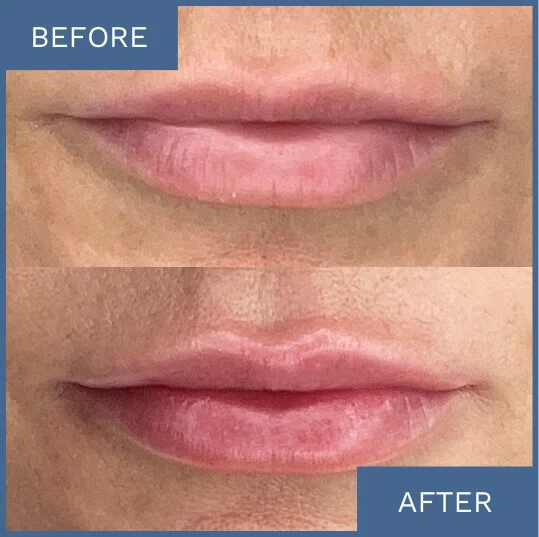 See Visible Results