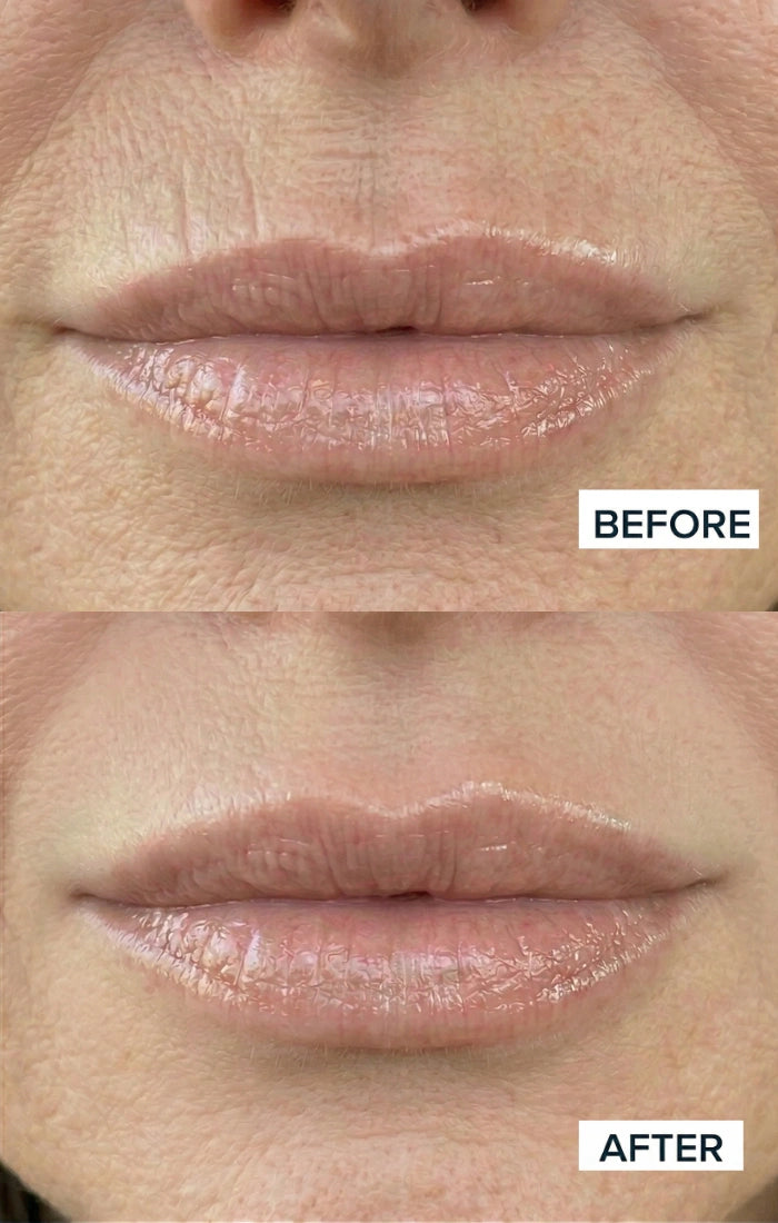Before and after result
