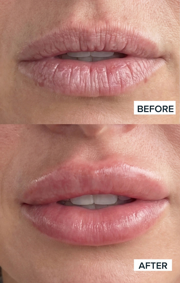 Before and after result