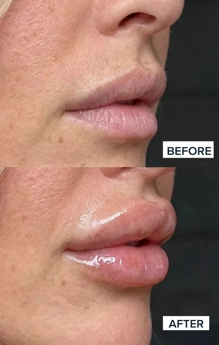 Before and after result