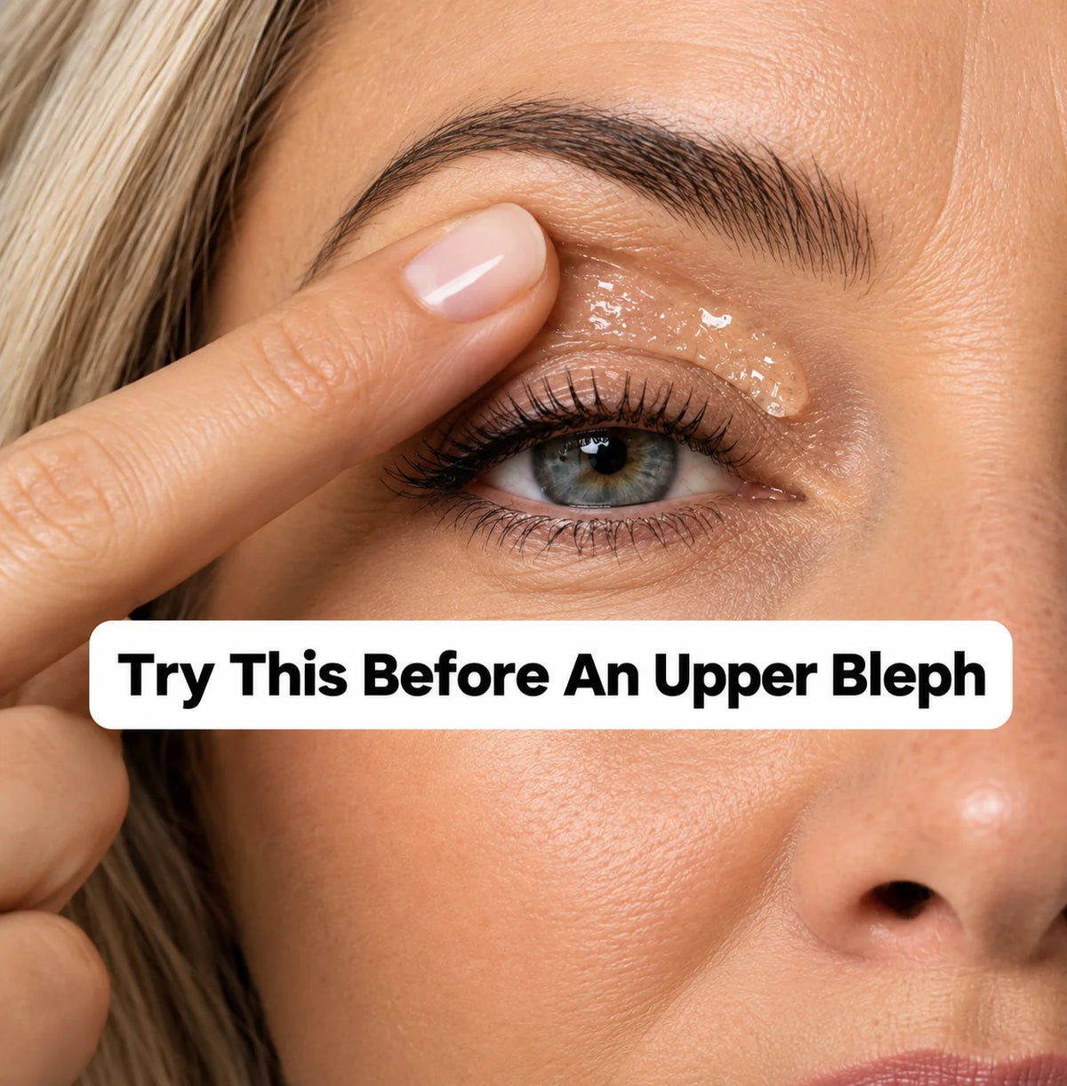 <i>Considering An Upper Bleph or Lid Lift? Here's Why 50,000+ Women Canceled Their Appointments</i>