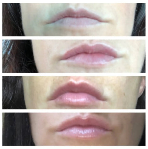 Real Customer Results: